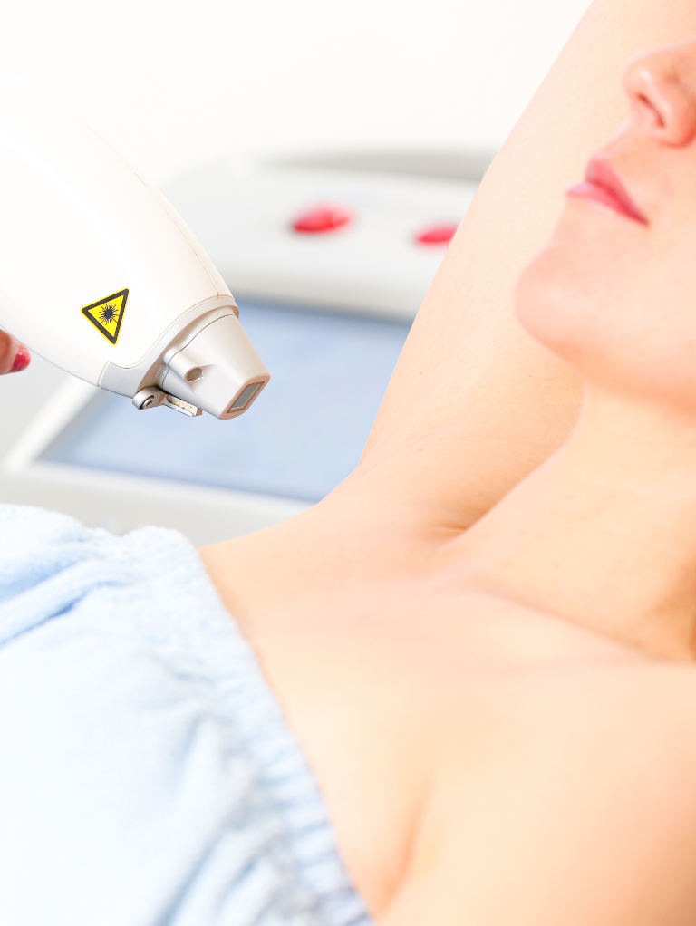 chest laser hair removal for women
