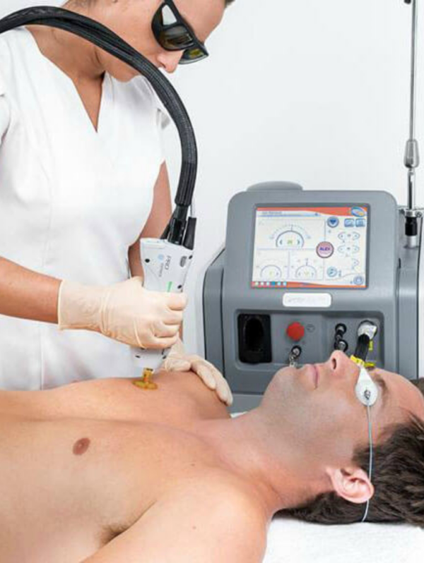 Chest laser hair removal