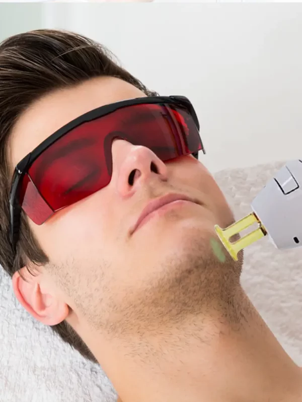chin laser hair removal for men