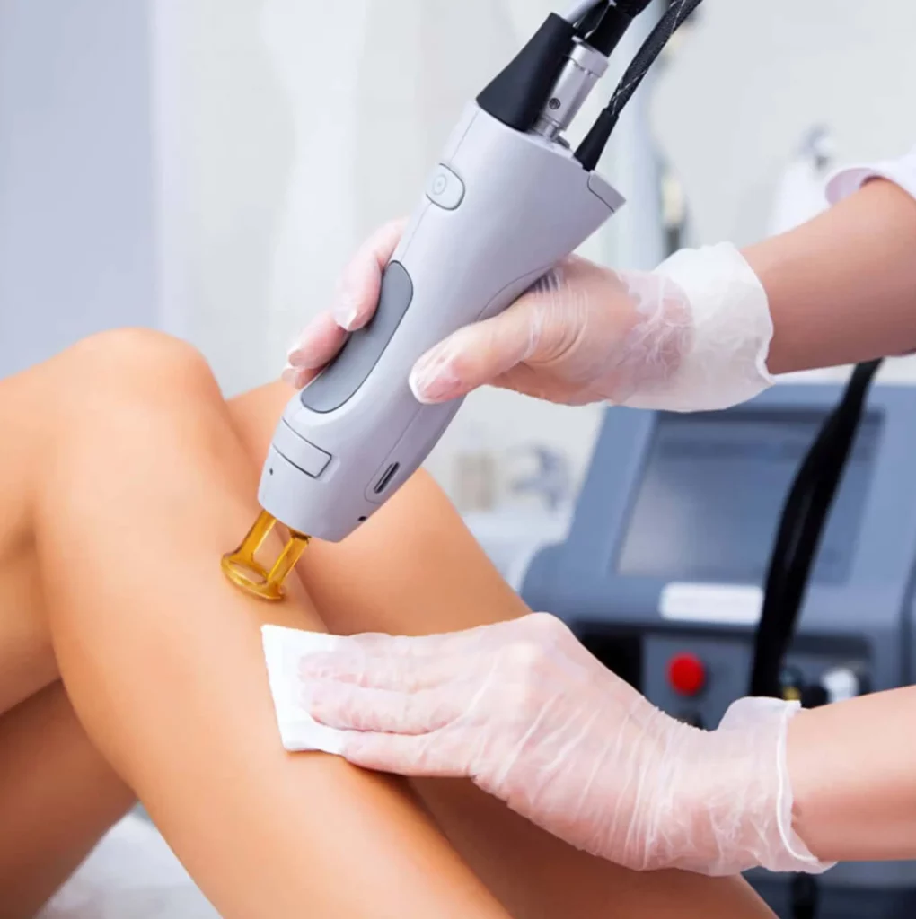 Laser Hair Removal in Greenwich - Best Electrolysis Hair Removal Clinic