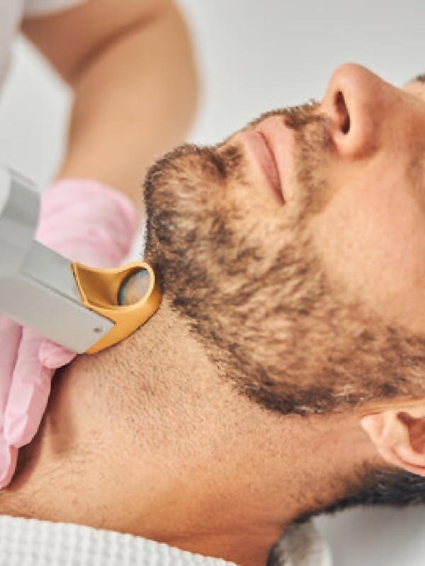 neck laser hair removal