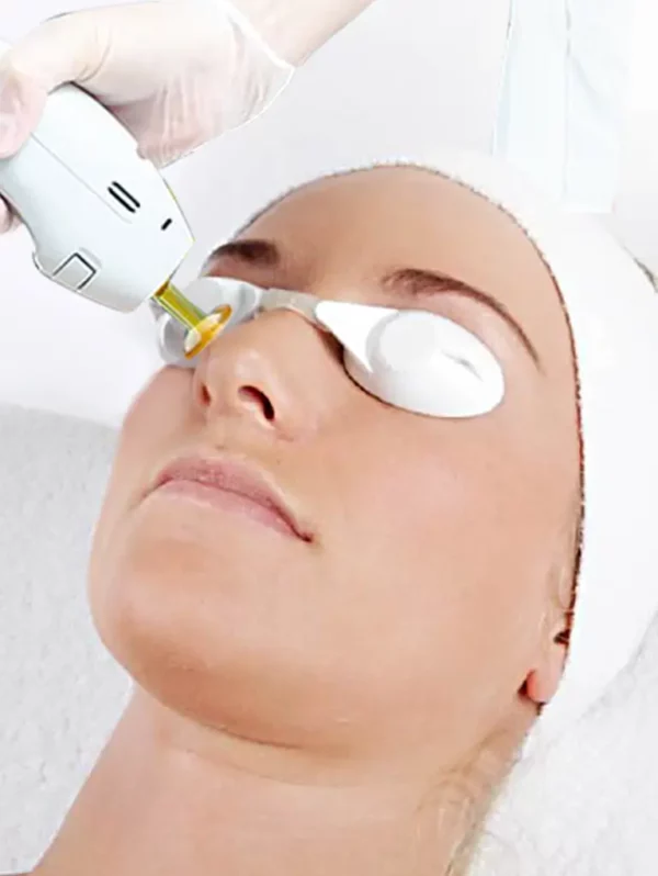 nose laser hair removal for women
