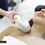 procedure of laser hair removal treatment