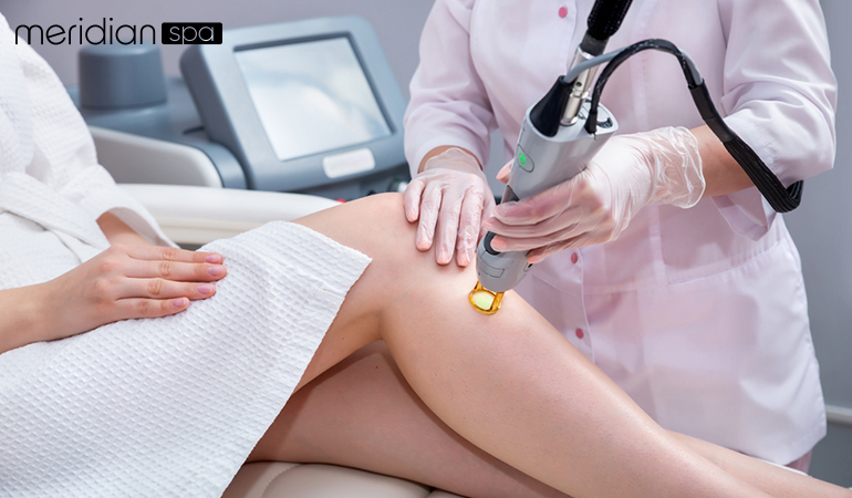 How You Can Prepare Yourself For Laser Treatment