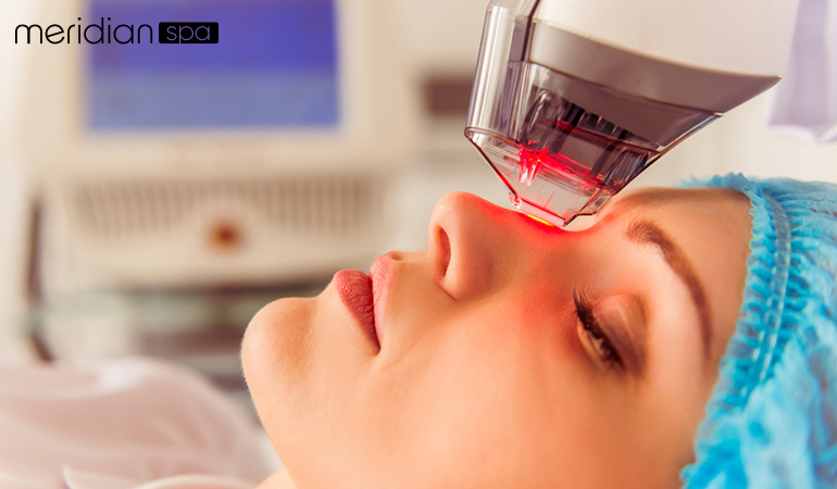 Why Choose Laser Treatment