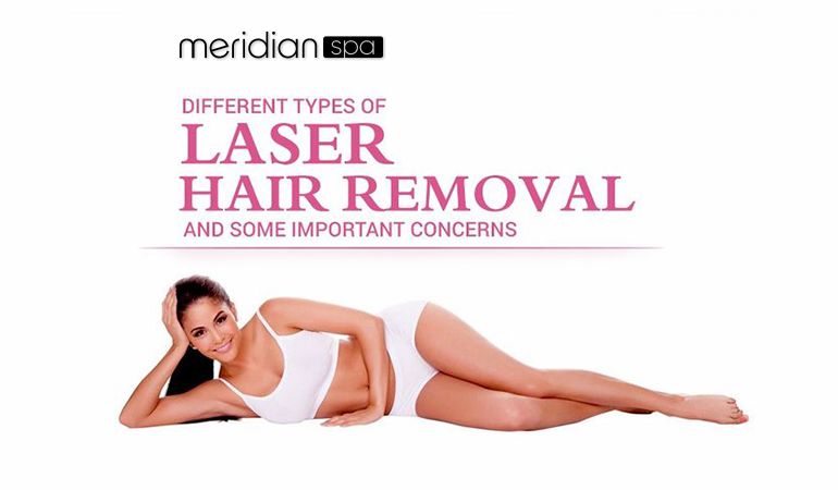 Common Types Of Hair Removal Lasers Image