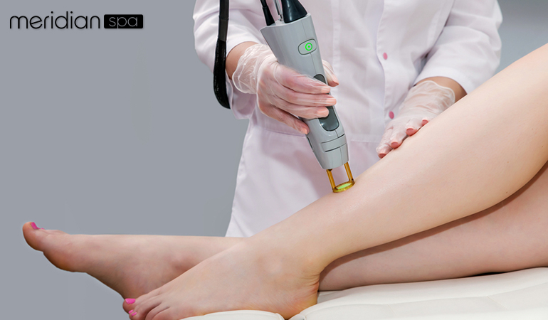 How Laser Hair Removal Technology Is The Best Option Image