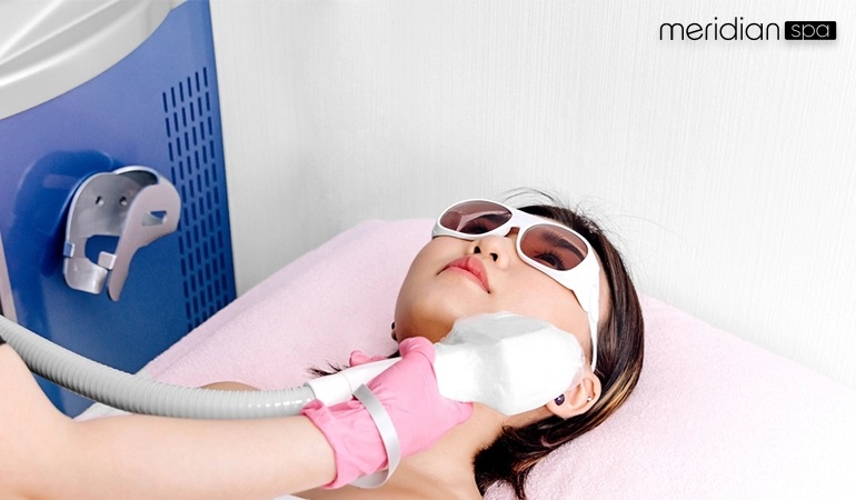 What happens during laser hair removal
