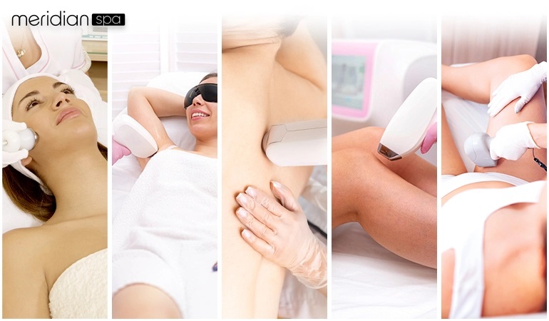 What is laser hair removal
