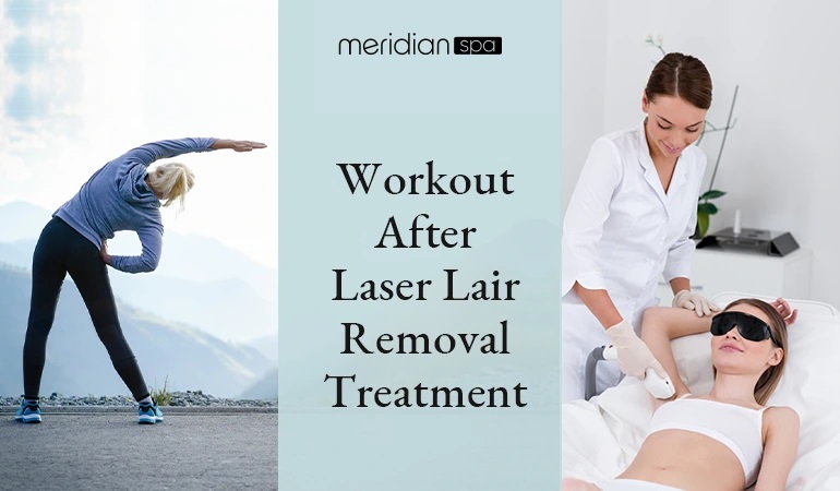 Can You Exercise After Laser Hair Removal 