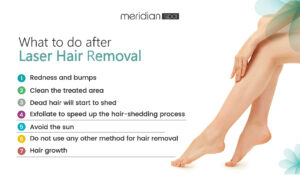 What to do after laser hair removal treatment