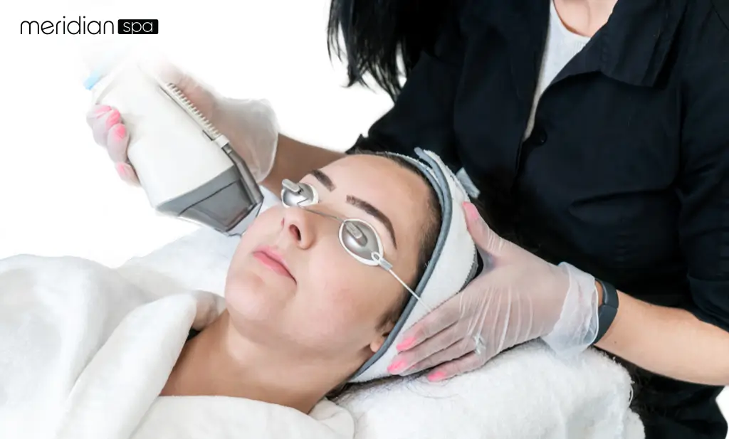 Non-Ablative Laser Resurfacing