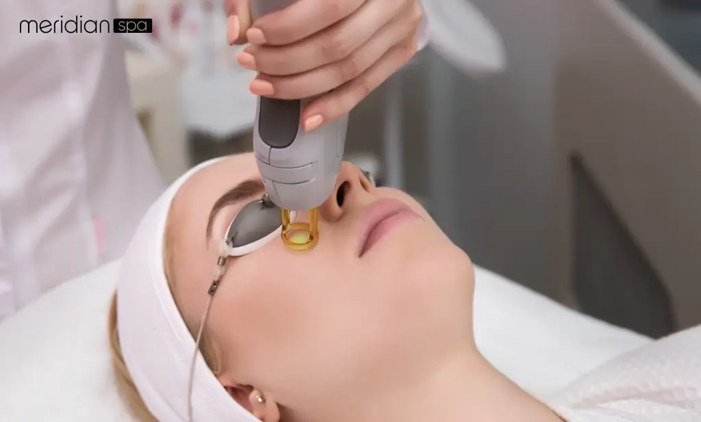 What Is a Facial Laser Treatment?