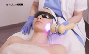 Facial Laser Treatment