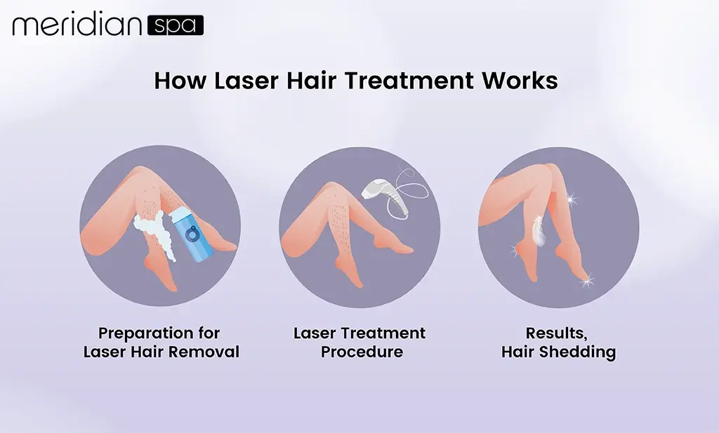How Laser Hair Treatment Works