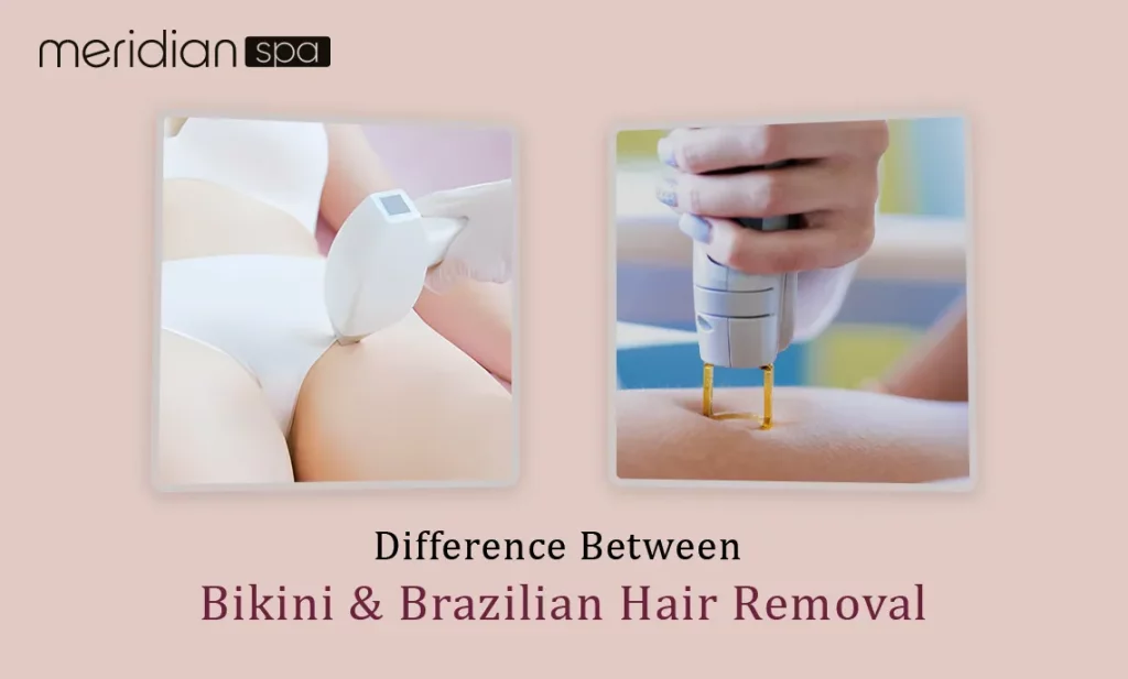 Comparison image showing a bikini bottom and a Brazilian flag, representing the difference between bikini and Brazilian hair removal techniques.