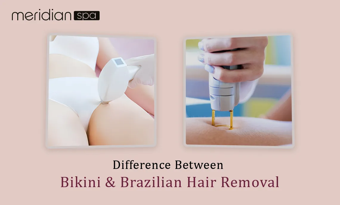 Difference Between Bikini & Brazilian Hair Removal 