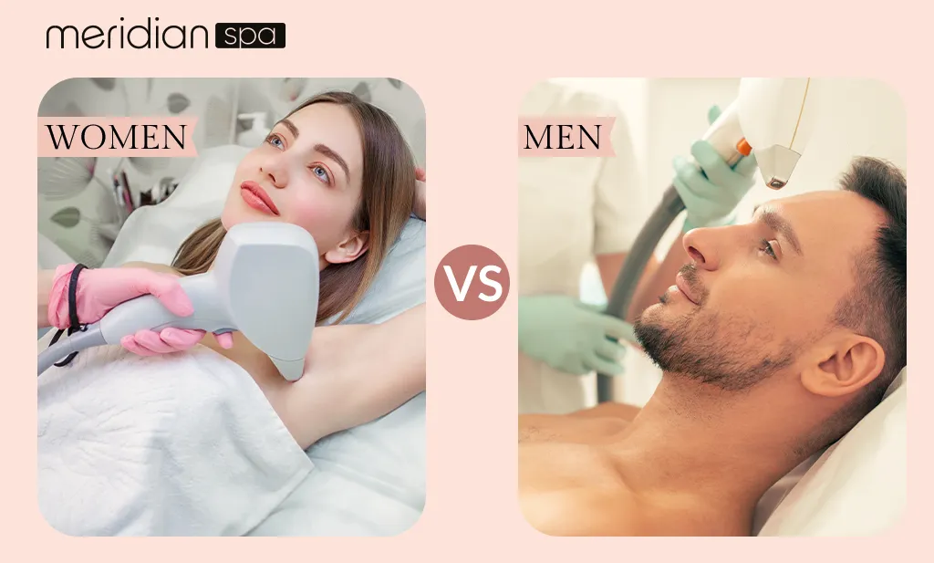 Comparison of laser hair removal treatment areas for women and men, illustrating differences in target zones and hair density.