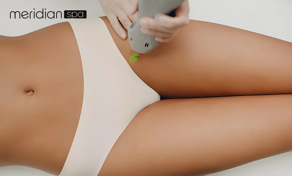 Image showing a pamphlet titled 'Are Bikini Laser and Brazilian Laser Hair Removal Right for You?' with pictures of laser hair removal procedures.