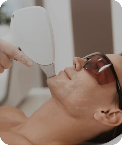 Chin Laser Hair Removal - Men