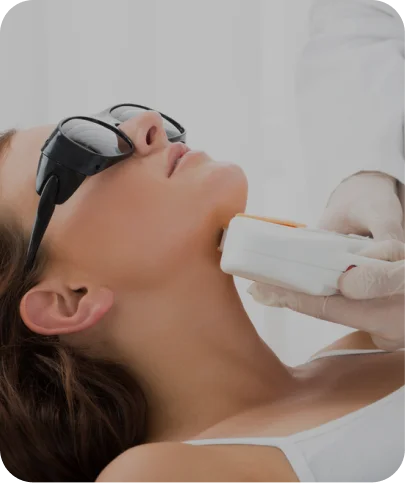 Chin Laser Hair Removal Treatments