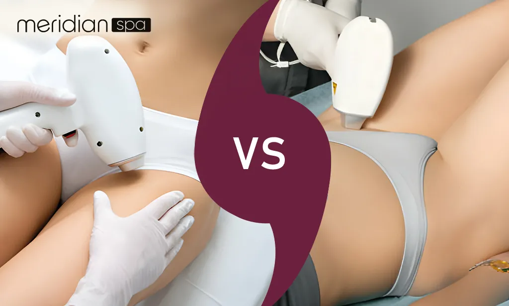 Image comparing Brazilian hair removal and bikini hair removal methods, highlighting differences in technique, coverage, and results.