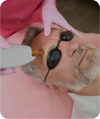 Full Face Laser Hair Removal - Men