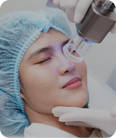 Nose Laser Hair Removal Treatments