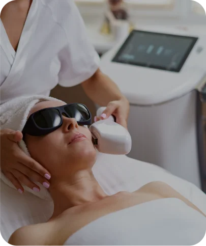Side of Face Laser Hair Removal Treatments