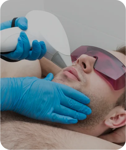 Upper Lip Laser Hair Removal - Men