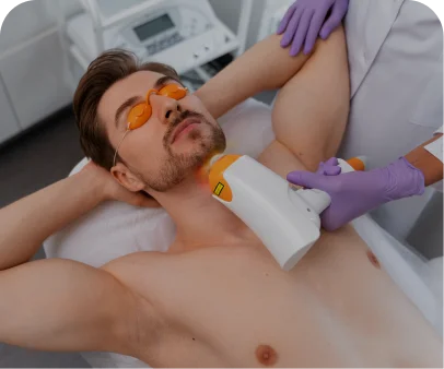 Men’s Laser Hair Removal Service