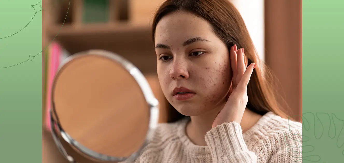 Environmental Factors That Contribute To Acne - Tips For Prevention