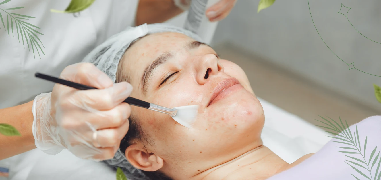 Facials for Acne Management An Evidence-Based Approach